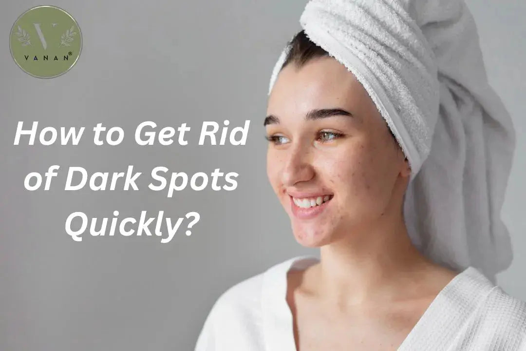 How to Get Rid of Dark Spots Quickly? Achieve Flawless Skin Naturally ...
