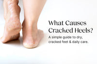 What Causes Cracked Heels? A Simple Guide to Dry, Cracked Feet & Daily Care