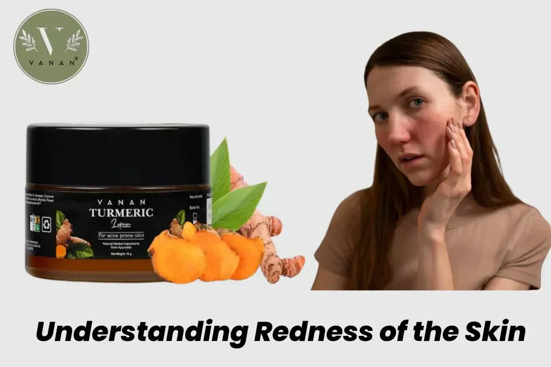 Redness of the Skin